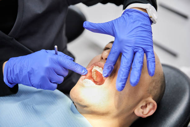 Emergency Dental Filling Replacement in MN
